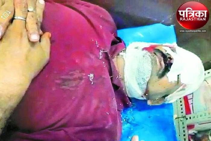 उदयपुर: अलीपुरा में आदतन अपराधी ने पूर्व पार्षद को मारे चाकू, चेहरे पर आई गंभीर चोट