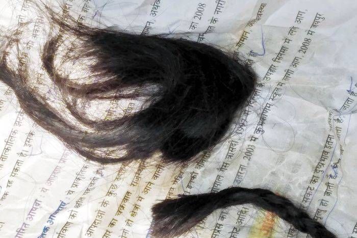Panic from women peak bites महिलाओं की चोटी काटने से दहशत