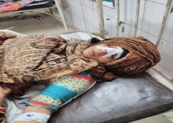 सड़क हादसे में घायल फंसे जीप में, गाड़ी काटकर निकला